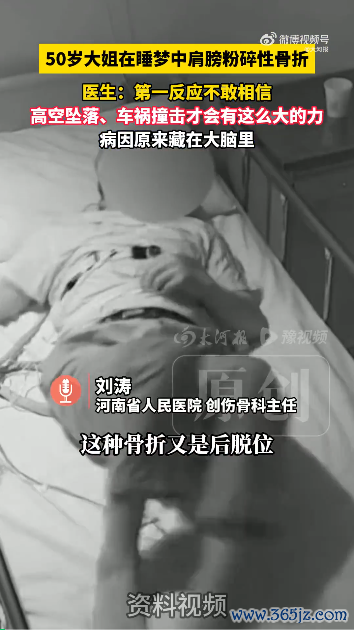 58配资 罕见！女子睡梦中肩膀粉碎性骨折，骨头碎成七八块，竟是这个原因......